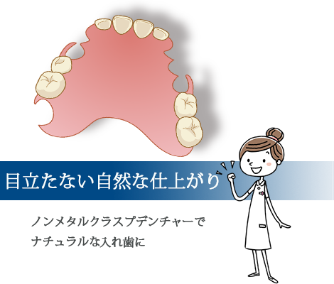 ノンメタルクラスプデンチャーの説明画像090