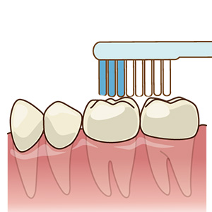 なかがわ歯科の予防歯科の画像